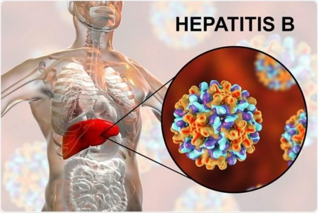 hepatitis-4-750x501